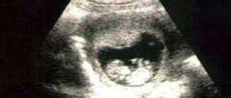 Elvte uke av svangerskapet - hva skjer med babyen, foto av fosteret, opplevelser